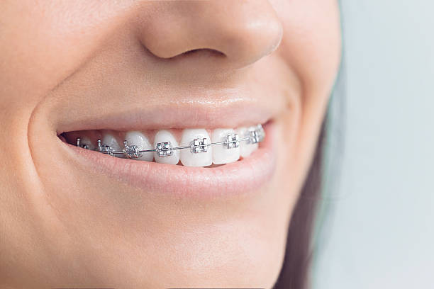 Best Full Mouth Reconstruction  in Huntington Park, CA